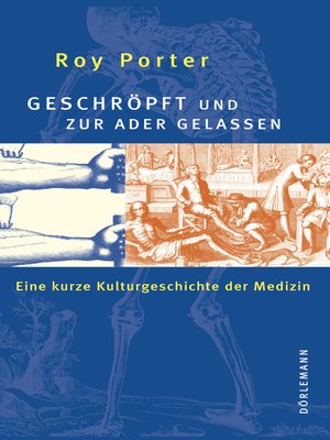 cover image of Geschröpft und zur Ader gelassen